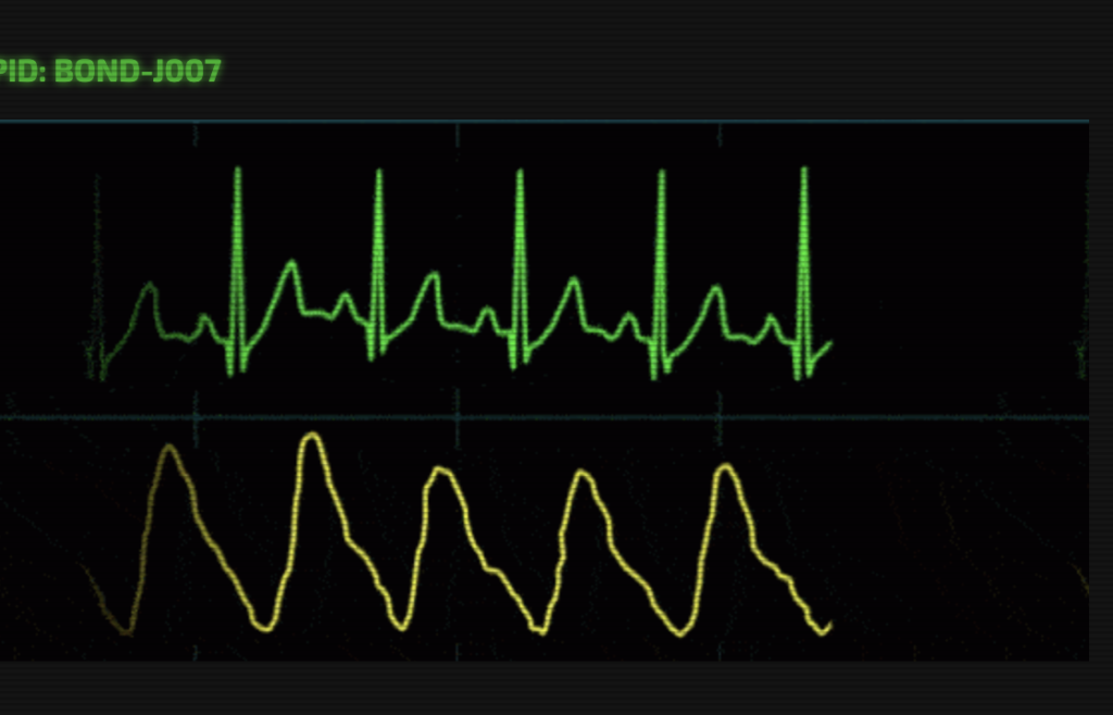 UI Code Challenge #1 &#8211; Heartbeats